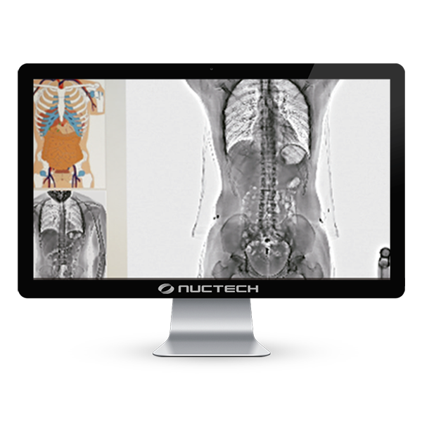 escaner-de-cuerpo-humano-nuctech-ht2100dv escaner-de-cuerpo-humano-nuctech-ht2100dv