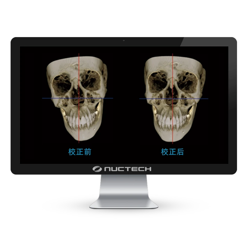 tomografo-dental-largev-smart3d-x-cbct-pantalla tomografo-dental-largev-smart3d-x-cbct-pantalla